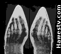 X-ray of
             woman's feet might have come from a shoe-fitting fluoroscope